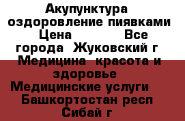 Акупунктура, оздоровление пиявками › Цена ­ 3 000 - Все города, Жуковский г. Медицина, красота и здоровье » Медицинские услуги   . Башкортостан респ.,Сибай г.